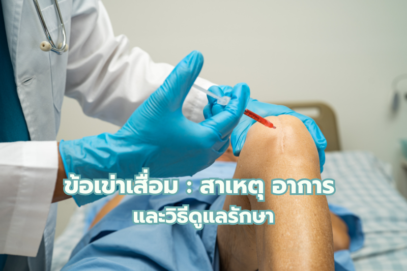ข้อเข่าเสื่อม : สาเหตุ อาการ และวิธีดูแลรักษา