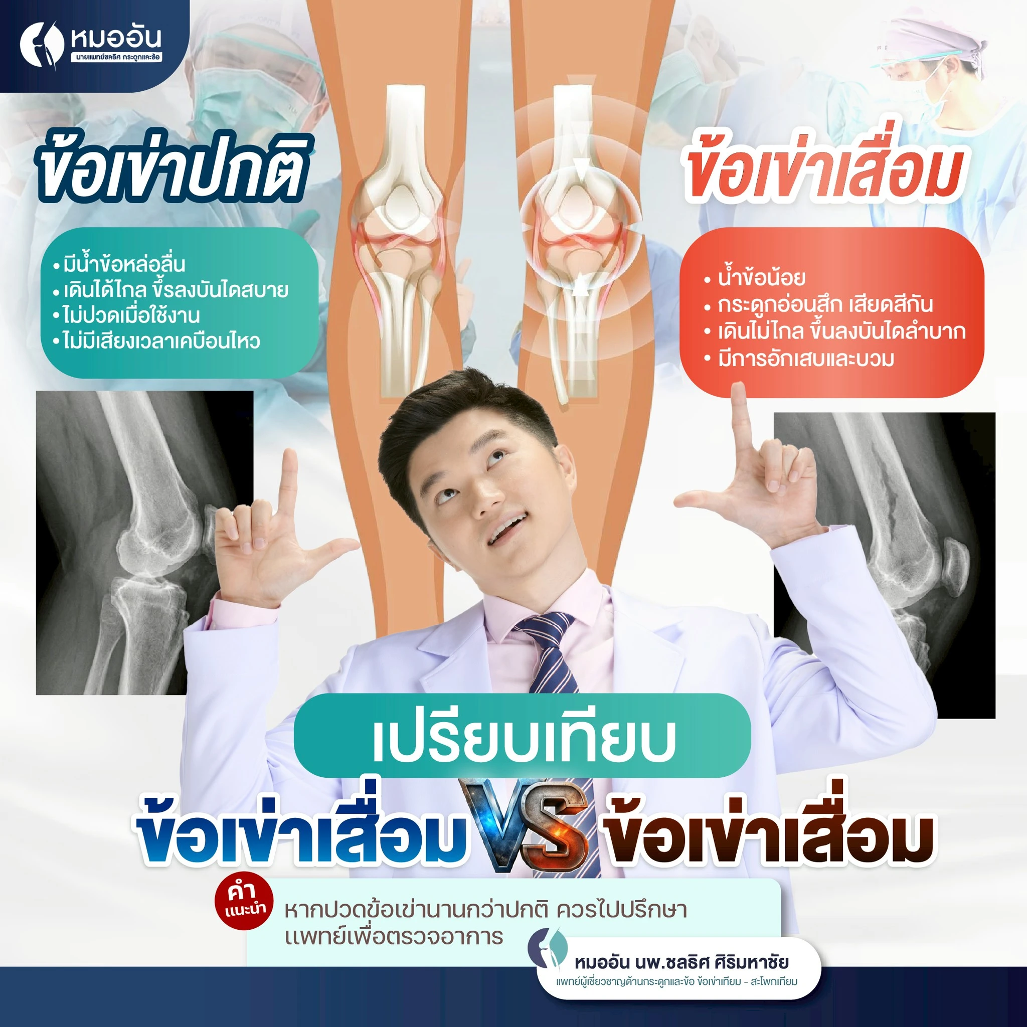 เปรียบเทียบข้อเข่าปกติและข้อเข่าเสื่อม