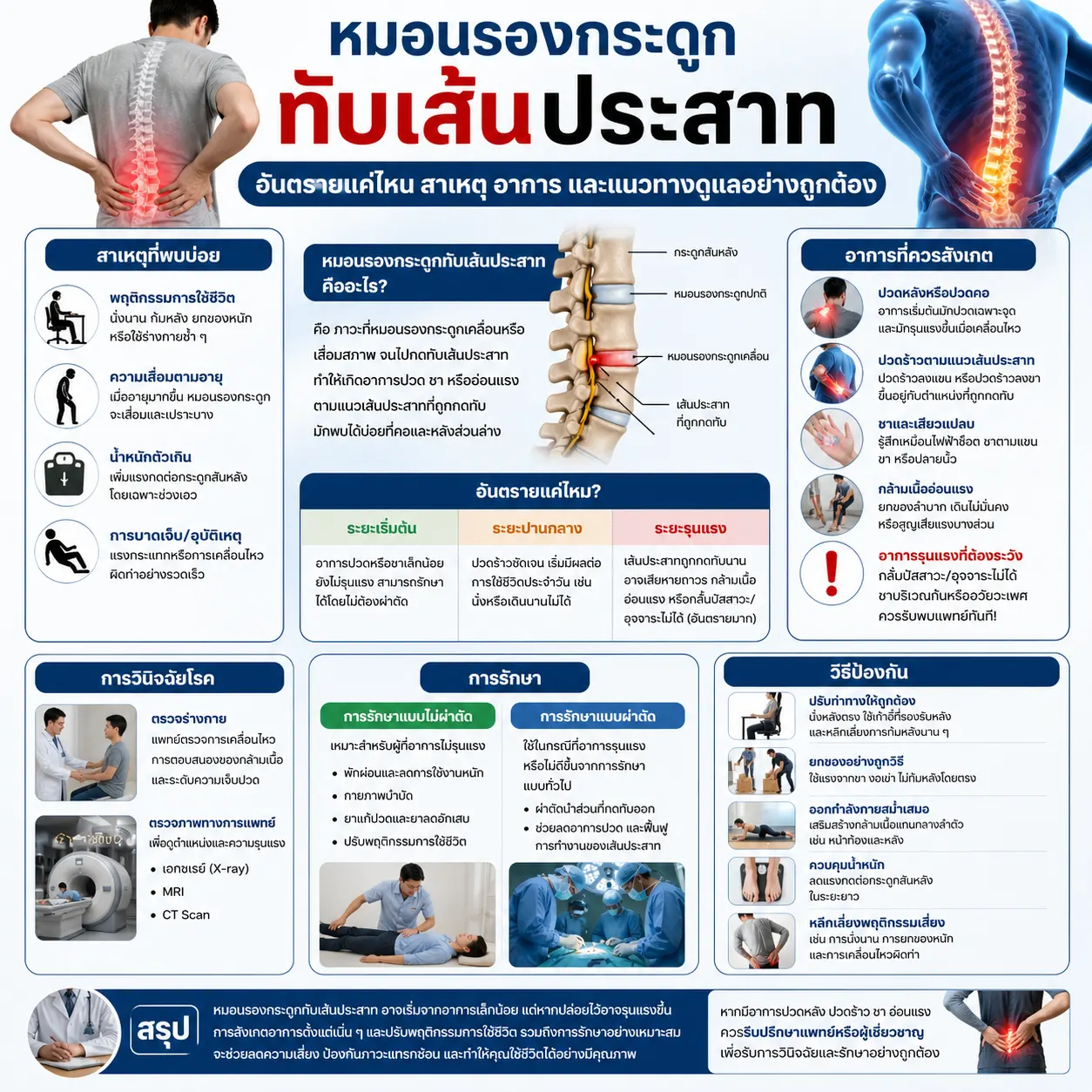หมอนรองกระดูกทับเส้นประสาท อันตรายแค่ไหน สาเหตุ อาการ และแนวทางดูแลอย่างถูกต้อง
