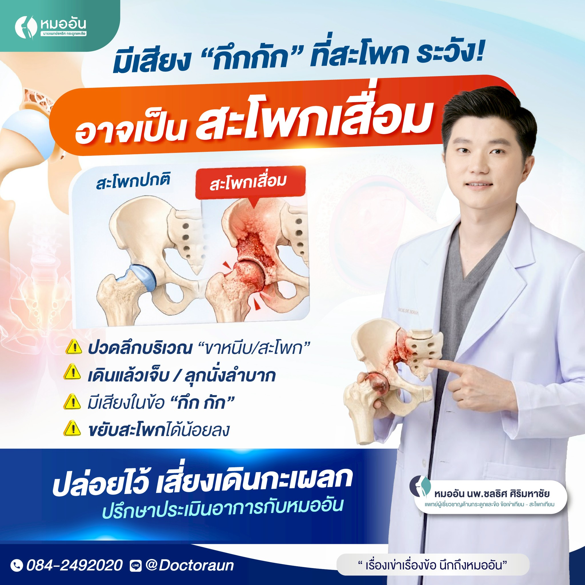 มีเสียง “กึกกึก” ที่สะโพก ระวัง อาจเป็น “สะโพกเสื่อม” โดยไม่รู้ตัว